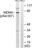 MDMX (phospho Ser367) Polyclonal Antibody