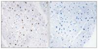 BLM (phospho Thr99) Polyclonal Antibody