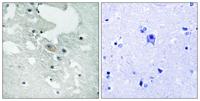 BLNK (phospho Tyr84) Polyclonal Antibody