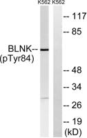 BLNK (phospho Tyr84) Polyclonal Antibody