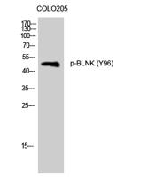 BLNK (phospho Tyr96) Polyclonal Antibody