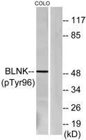 BLNK (phospho Tyr96) Polyclonal Antibody