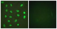 MEF-2 (phospho Ser408) Polyclonal Antibody