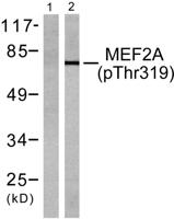 MEF-2 (phospho Thr319) Polyclonal Antibody