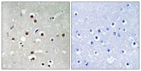 MEF-2C (phospho Ser396) Polyclonal Antibody