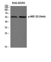 MEF-2D (phospho Ser444) Polyclonal Antibody