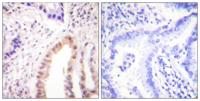 MEF-2D (phospho Ser444) Polyclonal Antibody