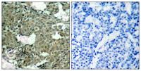 MEK-1/2 (phospho Ser222/226) Polyclonal Antibody