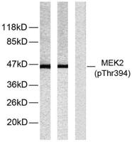 MEK-2 (phospho Thr394) Polyclonal Antibody