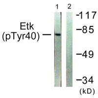 Bmx (phospho Tyr40) Polyclonal Antibody