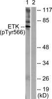 Bmx (phospho Tyr566) Polyclonal Antibody