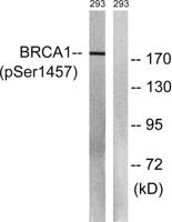 BRCA1 (phospho Ser1457) Polyclonal Antibody