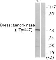 Brk (phospho Tyr447) Polyclonal Antibody