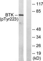 Btk (phospho Tyr223) Polyclonal Antibody