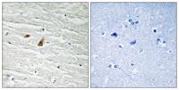 C/EBP ε (phospho Thr74) Polyclonal Antibody