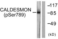 Caldesmon (phospho Ser789) Polyclonal Antibody