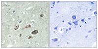 Calmodulin-1 (phospho Thr80/S82) Polyclonal Antibody