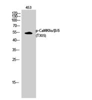 CaMKIIα/β/δ (phospho Thr305) Polyclonal Antibody