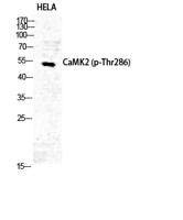 CaMKIIα/δ (phospho Thr286) Polyclonal Antibody