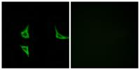 CaMKIIα/δ (phospho Thr286) Polyclonal Antibody