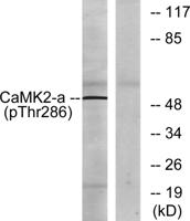 CaMKIIα/δ (phospho Thr286) Polyclonal Antibody