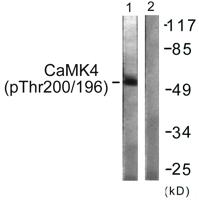 CaMKIV (phospho Thr200) Polyclonal Antibody