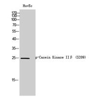 Casein Kinase IIβ (phospho Ser209) Polyclonal Antibody