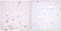 Casein Kinase IIβ (phospho Ser209) Polyclonal Antibody