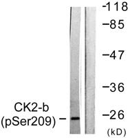 Casein Kinase IIβ (phospho Ser209) Polyclonal Antibody