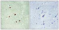 Max (phospho Ser2) Polyclonal Antibody