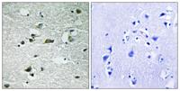 Casein Kinase Iγ1/2/3 (phospho Tyr263) Polyclonal Antibody