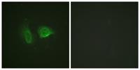 CaSR (phospho Thr888) Polyclonal Antibody