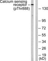 CaSR (phospho Thr888) Polyclonal Antibody