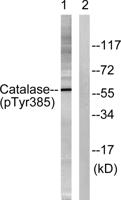 Catalase (phospho Tyr386) Polyclonal Antibody