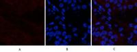 Catenin-β (phospho Ser37) Polyclonal Antibody