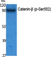 Catenin-β (phospho Ser552) Polyclonal Antibody