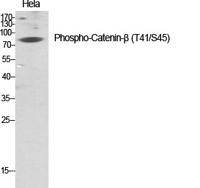 Catenin-β (phospho Thr41/S45) Polyclonal Antibody