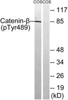 Catenin-β (phospho Tyr489) Polyclonal Antibody