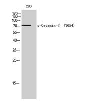 Catenin-β (phospho Tyr654) Polyclonal Antibody