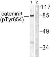 Catenin-β (phospho Tyr654) Polyclonal Antibody