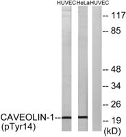 Caveolin-1 (phospho Tyr14) Polyclonal Antibody