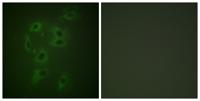 Cbl (phospho Tyr700) Polyclonal Antibody