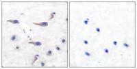 MARCKS (phospho Ser163) Polyclonal Antibody