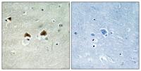 MAP-4 (phospho Ser696) Polyclonal Antibody