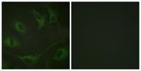 Cbl (phospho Tyr774) Polyclonal Antibody