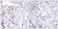 Cbl (phospho Tyr774) Polyclonal Antibody