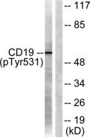 CD19 (phospho Tyr531) Polyclonal Antibody