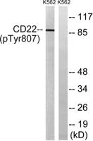 CD22 (phospho Tyr807) Polyclonal Antibody