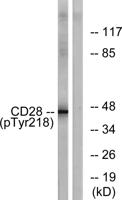 CD28 (phospho Tyr218) Polyclonal Antibody