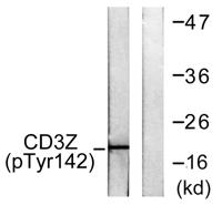 CD3 ζ (phospho Tyr142) Polyclonal Antibody